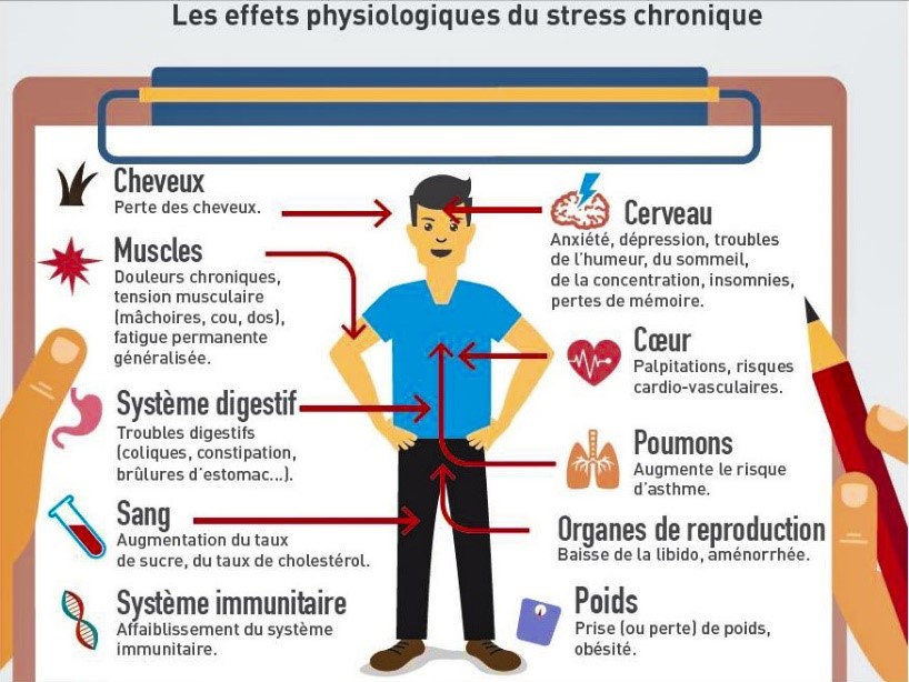 Image 6 Stress